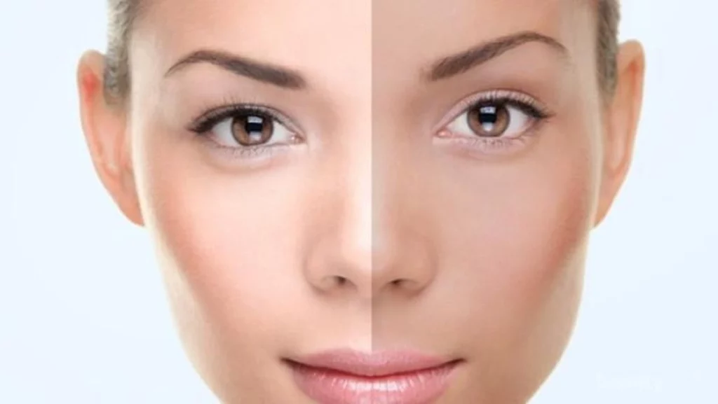 Pemutih Kulit & Melanin: Mitos atau Kenyataan?